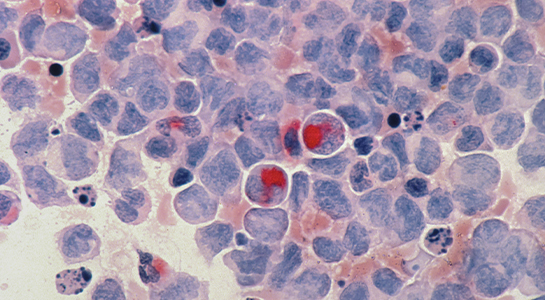 Imagen de Descifrando el código del cáncer